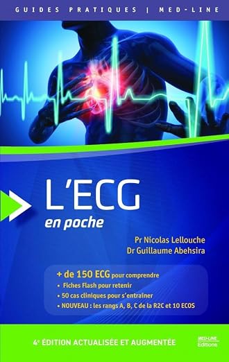 L'ECG en poche